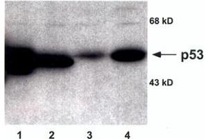 Image no. 1 for anti-Tumor Protein P53 (TP53) antibody (ABIN295785) (p53 Antikörper)