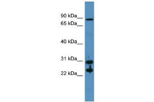 Western Blotting (WB) image for anti-Carbonic Anhydrase II (CA2) (N-Term) antibody (ABIN617260) (CA2 Antikörper  (N-Term))