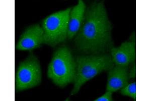 A549 cells were fixed in paraformaldehyde, permeabilized with 0. (Cytokeratin 7 Antikörper)