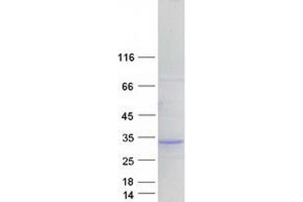 HLA-DQB2 Protein (Myc-DYKDDDDK Tag)