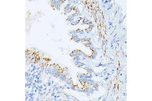 Immunohistochemistry of paraffin-embedded rat lung using IL3RA antibody (ABIN1680453, ABIN3018298, ABIN3018299, ABIN5664529 and ABIN6220429) at dilution of 1:100 (40x lens). (IL3RA Antikörper  (AA 1-100))