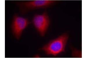 Image no. 2 for anti-Protein Kinase C, theta (PRKCQ) (AA 674-678) antibody (ABIN197567) (PKC theta Antikörper  (AA 674-678))