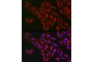 Immunofluorescence analysis of U2OS cells using NQO1 Rabbit pAb (ABIN1681096, ABIN3015018, ABIN3015019 and ABIN6213595) at dilution of 1:50 (40x lens). (NQO1 Antikörper  (AA 1-274))