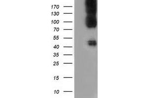 HEK293T cells were transfected with the pCMV6-ENTRY control (Left lane) or pCMV6-ENTRY CD80 (Right lane) cDNA for 48 hrs and lysed. (CD80 Antikörper)