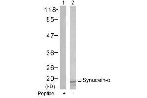 Image no. 1 for anti-Synuclein, alpha (SNCA) (Tyr125) antibody (ABIN197502) (SNCA Antikörper  (Tyr125))