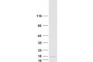 Validation with Western Blot (CALCB Protein (Myc-DYKDDDDK Tag))