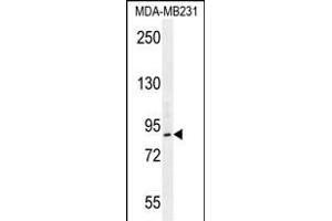 PCAF Antibody (N-term) (ABIN656012 and ABIN2845388) western blot analysis in MDA-M cell line lysates (35 μg/lane). (KAT2B Antikörper  (N-Term))