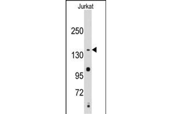 SMC2 Antikörper  (C-Term)