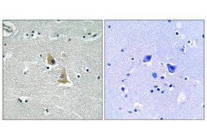 Immunohistochemistry (IHC) image for anti-Neutrophil Cytosol Factor 1 (NCF1) (Ser345) antibody (ABIN1848361) (NCF1 Antikörper  (Ser345))