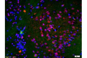 Formalin-fixed and paraffin embedded rat brain labeled with Anti-Histone H3 (Di Methyl K9) Polyclonal Antibody, Unconjugated (ABIN703886) at 1:200 followed by conjugation to the secondary antibody Goat Anti-Rabbit IgG, Cy3 conjugated used at 1:200 dilution for 40 minutes at 37 °C and DAPI staining (Histone 3 Antikörper  (H3K9me))