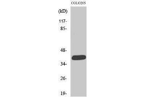 Western Blotting (WB) image for anti-Solute Carrier Family 22 Member 18 (SLC22A18) (C-Term) antibody (ABIN3176679) (ORCTL-2/SLC22A18 Antikörper  (C-Term))