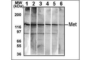 Western Blotting (WB) image for anti-Met Proto-Oncogene (MET) (Catalytic Domain) antibody (ABIN356341) (c-MET Antikörper  (Catalytic Domain))