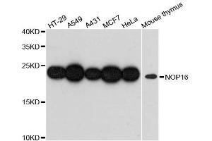 Western blot analysis of extracts of various cell lines, using NOP16 antibody. (NOP16 Antikörper  (AA 1-178))