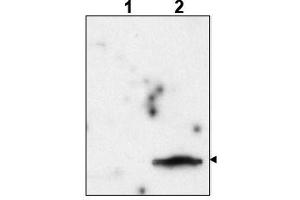 Image no. 1 for anti-FIV P24 Gag (Internal Region) antibody (ABIN401386) (FIV P24 Gag (Internal Region) Antikörper)