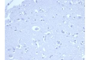 IHC analysis of formalin-fixed, paraffin-embedded human brain. (Rekombinanter p21 Antikörper  (AA 1-100))