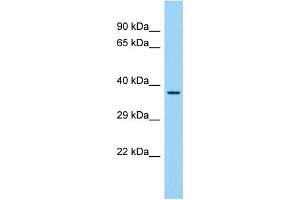 Host: Rabbit Target Name: FAM110C Sample Type: Fetal Liver lysates Antibody Dilution: 1. (FAM110C Antikörper  (N-Term))