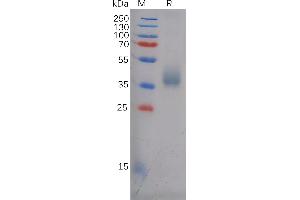Human AN Protein, His Tag on SDS-PAGE under reducing condition. (ANTXR1 Protein (AA 33-321) (His tag))