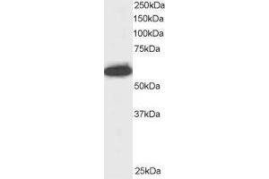 Western Blotting (WB) image for anti-Nucleoporin 50kDa (NUP50) antibody (ABIN5872779) (NUP50 Antikörper)