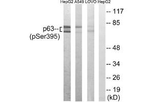 Western blot analysis of extracts from HepG2 cells, A549 cells and LOVO cells all treated with nocodazole (1 μg/mL, 18hours), using p63 (Phospho-Ser395) antibody. (p63 Antikörper  (pSer395))