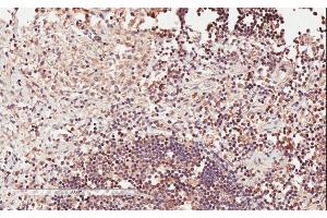 ABIN570765 (2µg/ml) staining of paraffin embedded Human Lymph Node. (ICOS Antikörper  (Internal Region))