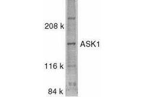 Western blot analysis of ASK1 in SW1353 whole cell lysate with ASK1 antibody at 0. (ASK1 Antikörper)