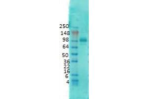 Western Blotting (WB) image for anti-Discs, Large Homolog 4 (Drosophila) (DLG4) antibody (ABIN6658152)