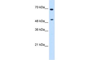 Western Blotting (WB) image for anti-Myc Proto-Oncogene protein (MYC) antibody (ABIN2460542) (c-MYC Antikörper)