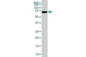 SOX9 polyclonal antibody (A01), Lot # 051017JC01 Western Blot analysis of SOX9 expression in Hela S3 NE . (SOX9 Antikörper  (AA 400-509))