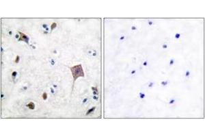 Immunohistochemistry analysis of paraffin-embedded human brain tissue, using PYK2 (Ab-580) Antibody. (PTK2B Antikörper  (AA 546-595))