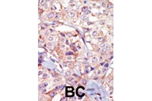 Immunohistochemistry (IHC) image for anti-Germ Cell Associated 2 (Haspin) (GSG2) antibody (ABIN3003656) (GSG2 Antikörper)