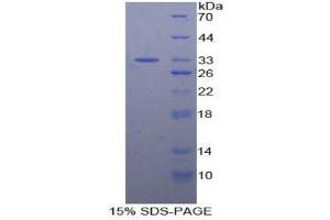 SDS-PAGE (SDS) image for N-Methylpurine-DNA Glycosylase (MPG) (AA 46-315) protein (His tag) (ABIN1879712) (MPG Protein (AA 46-315) (His tag))