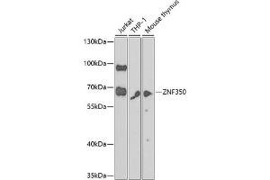 Western blot analysis of extracts of various cell lines, using ZNF350 antibody  at 1:1000 dilution. (ZNF350 Antikörper  (AA 233-532))