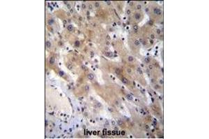 FGL1 Antibody (C-term) (ABIN656576 and ABIN2845837) immunohistochemistry analysis in formalin fixed and paraffin embedded human liver tissue followed by peroxidase conjugation of the secondary antibody and DAB staining. (FGL1 Antikörper  (C-Term))