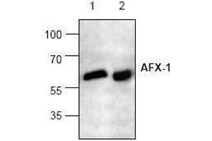 Image no. 1 for anti-Forkhead Box O4 (FOXO4) antibody (ABIN127087) (FOXO4 Antikörper)