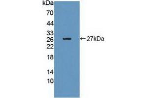 Detection of Recombinant Grb10, Human using Polyclonal Antibody to Growth Factor Receptor Bound Protein 10 (Grb10) (GRB10 Antikörper  (AA 392-594))