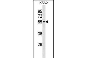 ESR2 Antibody (ABIN1539970 and ABIN2843879) western blot analysis in K562 cell line lysates (35 μg/lane). (ESR2 Antikörper  (AA 369-397))