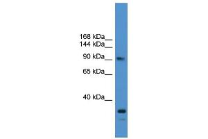 WB Suggested Anti-USP13 Antibody Titration: 0. (USP13 Antikörper  (N-Term))