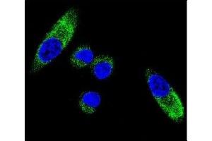 Confocal immunofluorescent analysis of CYP1A1 antibody with MDA-MB231 cells followed by Alexa Fluor 488-conjugated goat anti-rabbit lgG (green). (CYP1A1 Antikörper  (AA 252-280))