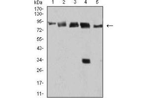 Western Blotting (WB) image for anti-DEAD (Asp-Glu-Ala-Asp) Box Polypeptide 1 (DDX1) (AA 642-740) antibody (ABIN5899136) (DDX1 Antikörper  (AA 642-740))
