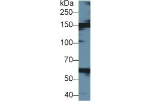 Detection of XDH in Bovine Liver lysate using Polyclonal Antibody to Xanthine Dehydrogenase (XDH) (XDH Antikörper  (AA 2-219))
