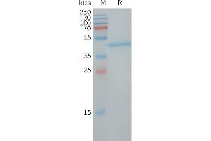 LY6H Protein (AA 26-115) (Fc Tag)