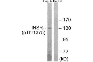 Western Blotting (WB) image for anti-IR (C-Term), (pThr1365), (pThr1375), (pThr1376) antibody (ABIN1847602) (IR (C-Term), (pThr1365), (pThr1375), (pThr1376) Antikörper)