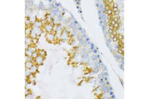 Immunohistochemistry of paraffin-embedded mouse testis using PTN Antibody. (Pleiotrophin Antikörper)
