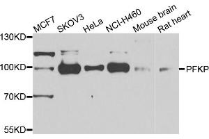 Western blot analysis of extracts of various cell lines, using PFKP antibody (ABIN5975671) at 1/1000 dilution. (PFKP Antikörper)