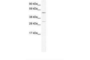 Image no. 1 for anti-Calcium/calmodulin-Dependent Protein Kinase IV (CAMK4) (AA 326-375) antibody (ABIN202605) (CAMK4 Antikörper  (AA 326-375))