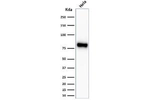 Western Blot Analysis of HeLa cell lysate using Beta-Catenin Recombinant Rabbit Monoclonal Antibody (CTNNB1/2030R). (Rekombinanter CTNNB1 Antikörper)