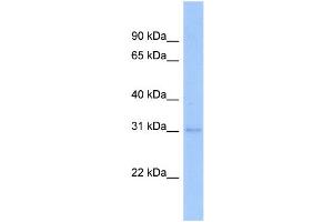 WB Suggested Anti-NFYB Antibody Titration:  0. (NFYB Antikörper  (Middle Region))