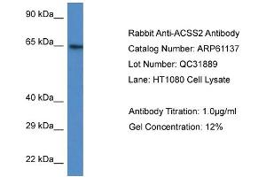 Western Blotting (WB) image for anti-Acyl-CoA Synthetase Short-Chain Family Member 2 (ACSS2) (N-Term) antibody (ABIN786342) (ACSS2 Antikörper  (N-Term))
