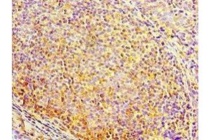 Immunohistochemistry of paraffin-embedded human tonsil tissue using ABIN7150705 at dilution of 1:100 (MAP2K3 Antikörper  (AA 1-170))