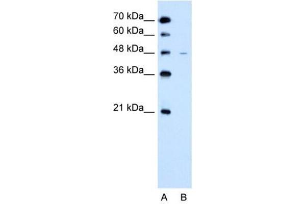 SLC43A3 Antikörper  (N-Term)